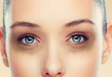 Due to dark circles under the eyes