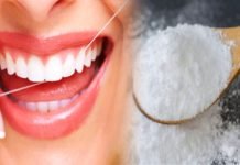दांतों के पीलेपन से है परेशान तो आजमाएं ये नुस्खों, फिर देखें असर teeth