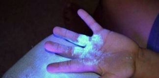 bacteria in your hand