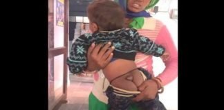 Neural tube defect baby in churu